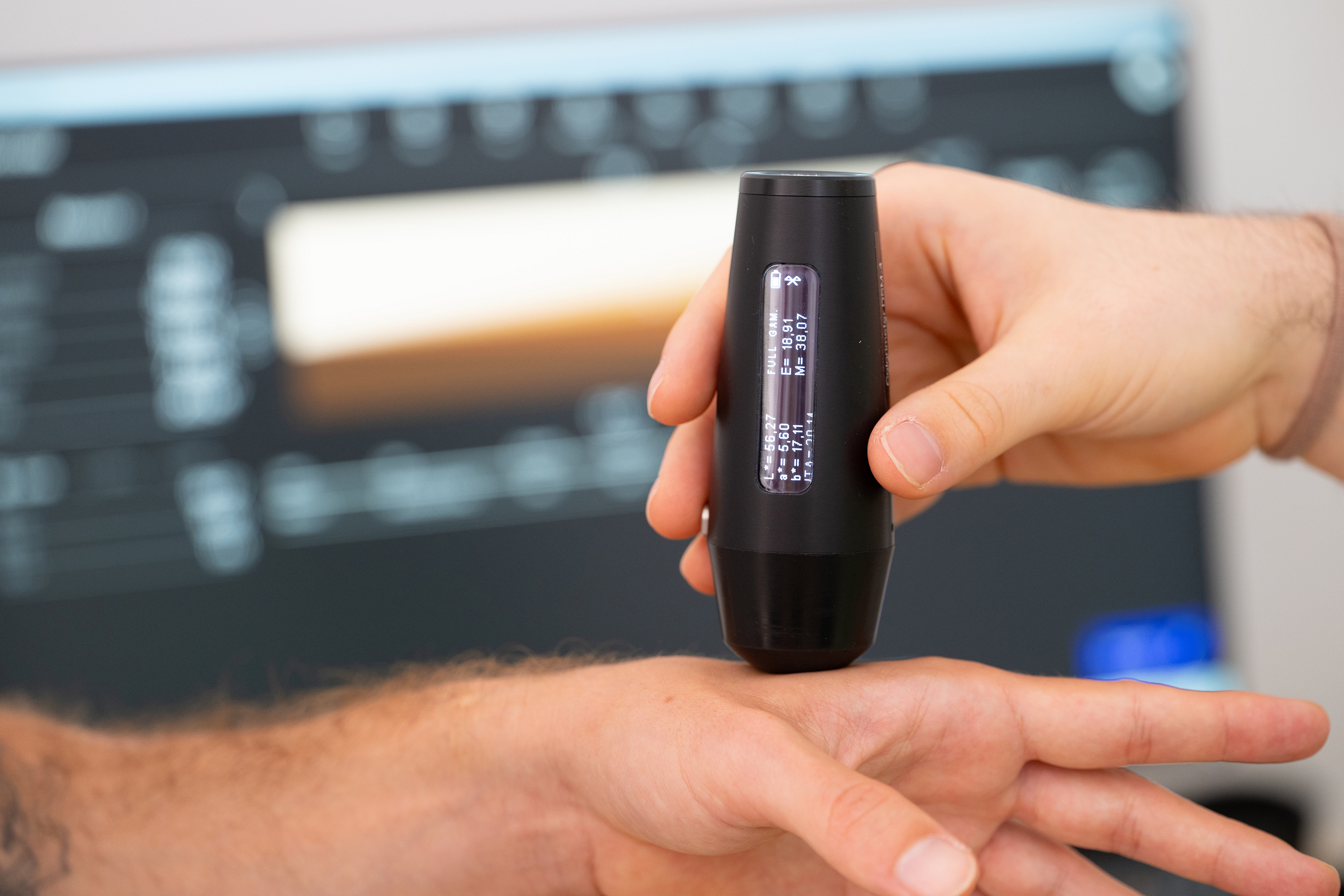 Colorimeter wird auf Arm gedrückt.